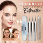 🎈 2026 Sale — Over 37,000 Sold! 🧴 Medical Grade Blackhead Extraction Tool Kit