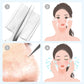 🎈 2026 Sale — Over 37,000 Sold! 🧴 Medical Grade Blackhead Extraction Tool Kit