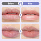 👑Sérum hidratante reafirmante y antiarrugas para los labios💋