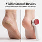 🦶 LIMITED-TIME 50% OFF! ✨ Double-Sided Foot Scraper for Callus – Stainless Steel, Dual Surface, Portable 🏃‍♀️