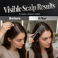 ✨ 2026 Sale — Over 31,800 Sold!💈 Scalp Applicator Comb Tool for Hair