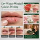 🎄💋Christmas Moisturizing Lip Balm Set – Hydrating, Long-Lasting, Perfect Holiday Gift